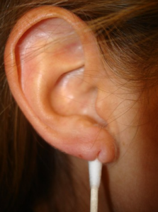 Split Earlobe